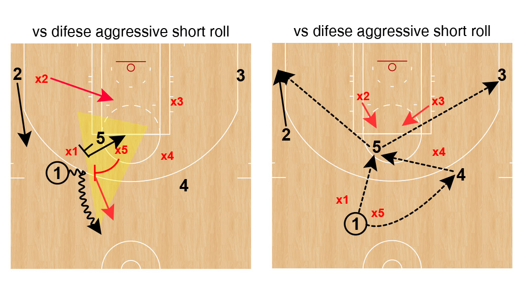 PNR contro trap con short roll